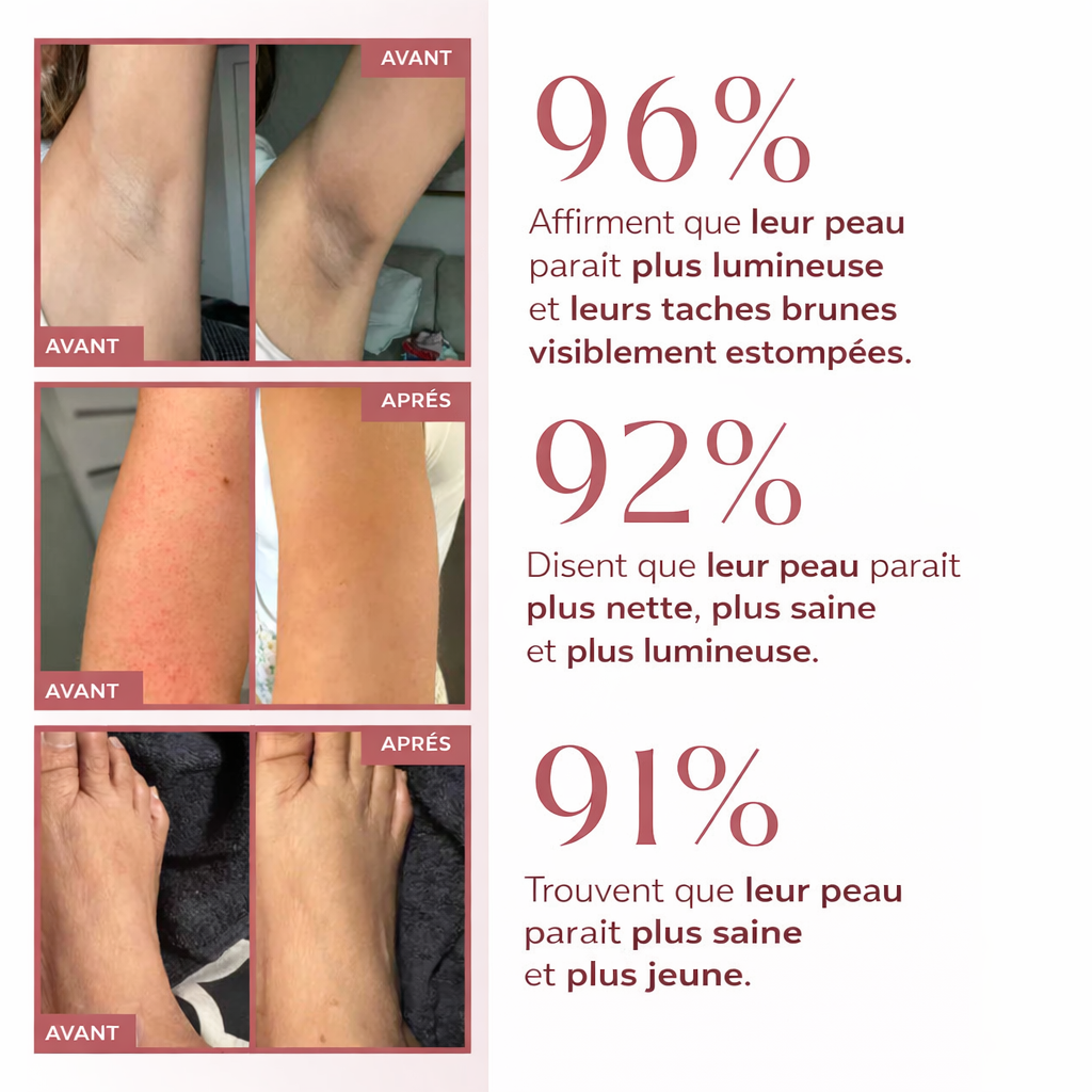 Spray Exfoliant Kojique & Curcuma — Olevia