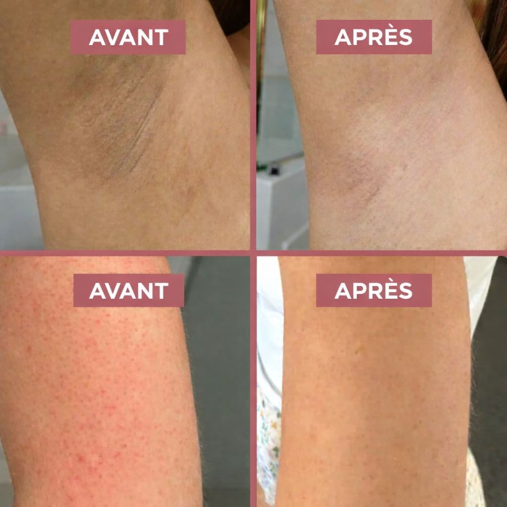 Spray Exfoliant Kojique & Curcuma — Olevia