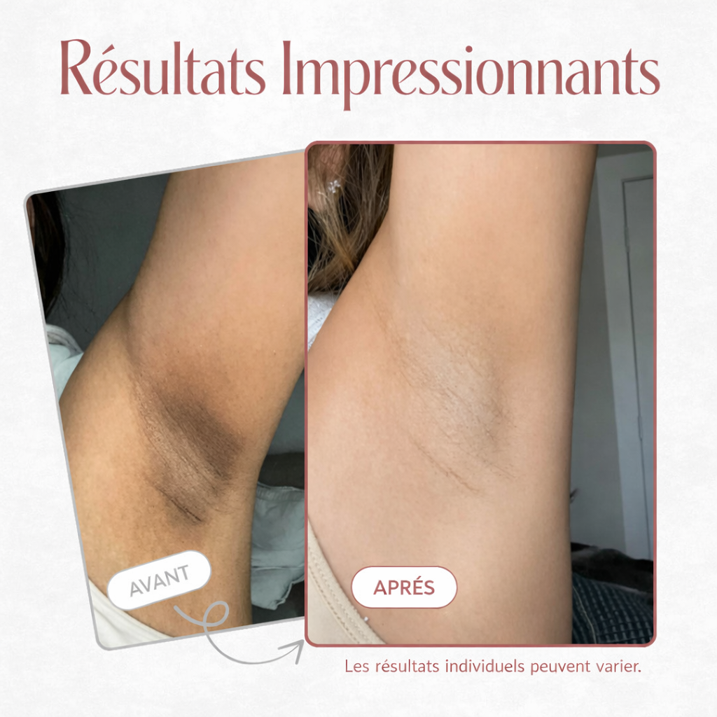 Spray Exfoliant Kojique & Curcuma — Olevia